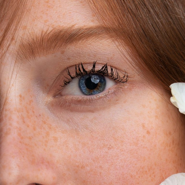 chirurgie des paupières